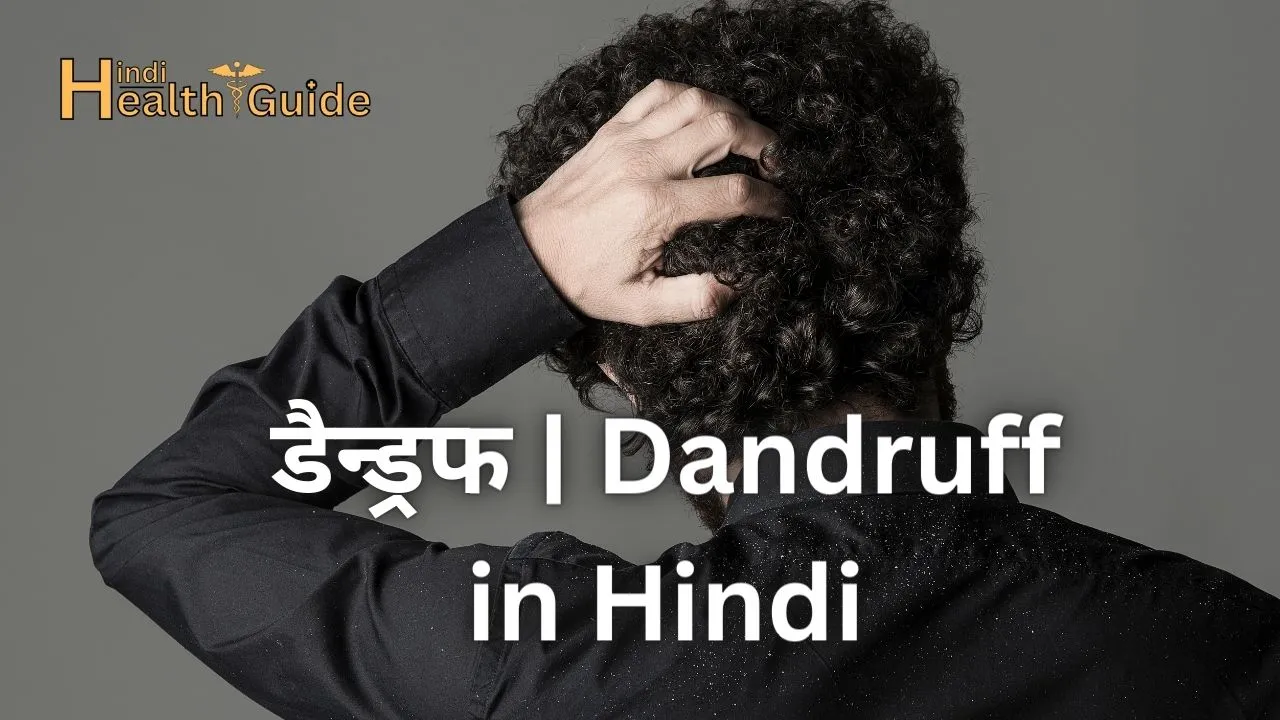 डैन्ड्रफ Dandruff in Hindi